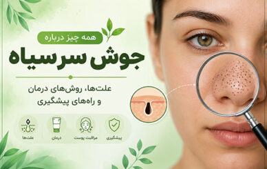 جوش سرسیاه