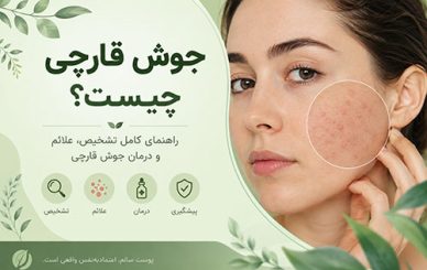 جوش قارچی