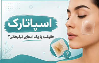 اسپاتارک